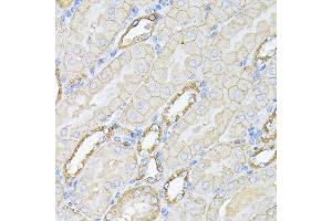 Immunohistochemistry (IHC) image for anti-Spectrin alpha Chain, Brain (SPTAN1) (AA 950-1130) antibody (ABIN6148403)