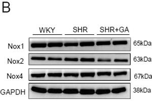 Western Blotting (WB) image for anti-NADPH Oxidase 1 (NOX1) antibody (ABIN2855720)
