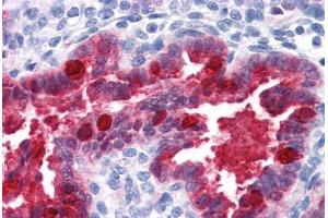 Human Uterus (formalin-fixed, paraffin-embedded) stained with NQO1 antibody ABIN364280 at 1:100 followed by biotinylated anti-mouse IgG secondary antibody ABIN481714, alkaline phosphatase-streptavidin and chromogen. (NQO1 抗体)