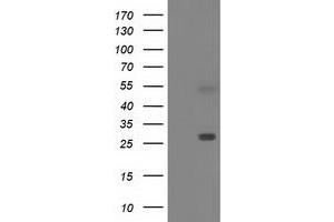 Western Blotting (WB) image for anti-Sepiapterin Reductase (SPR) antibody (ABIN1501112) (SPR 抗体)