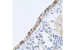 Immunohistochemistry (Paraffin-embedded Sections) (IHC (p)) image for anti-ST3 beta-Galactoside alpha-2,3-Sialyltransferase 3 (ST3GAL3) (AA 30-375) antibody (ABIN6148527)