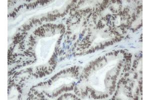Image no. 2 for anti-Splicing Factor 3a, Subunit 1 (SF3A1) (AA 249-568) antibody (ABIN1491272) (SF3A1 抗体  (AA 249-568))