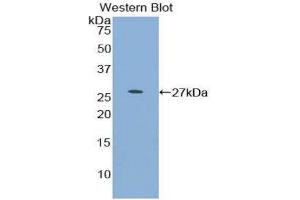 Western Blotting (WB) image for anti-Myocilin (MYOC) (AA 224-471) antibody (ABIN1859952) (MYOC 抗体  (AA 224-471))