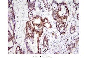 Immunohistochemistry (IHC) image for anti-High Mobility Group Box 1 (HMGB1) (AA 1-215), (N-Term) antibody (ABIN356226) (HMGB1 抗体  (N-Term))