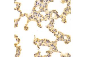 Immunohistochemistry (IHC) image for anti-Fatty Acid Binding Protein 4, Adipocyte (FABP4) (AA 1-132) antibody (ABIN3020736) (FABP4 抗体  (AA 1-132))