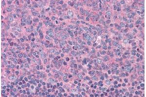 Human Tonsil: Formalin-Fixed, Paraffin-Embedded (FFPE) (ELP3/KAT9 抗体  (AA 240-445))