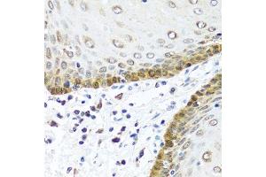 Immunohistochemistry of paraffin-embedded human esophagus using BMP5 antibody. (BMP5 抗体  (AA 317-454))