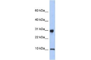 WB Suggested Anti-RPS21 Antibody Titration: 0. (RPS21 抗体  (N-Term))