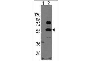 Western Blotting (WB) image for anti-SRY (Sex Determining Region Y)-Box 9 (SOX9) (AA 41-70), (N-Term) antibody (ABIN388162)