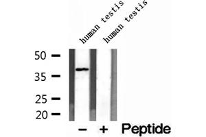 Western blot analysis of extracts of human testis tissue, using DNAJB14 antibody. (DNAJB14 抗体  (C-Term))