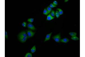 Immunofluorescence staining of Hela cells with ABIN7159221 at 1:133, counter-stained with DAPI. (MRAP 抗体  (AA 59-172))