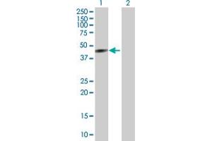 Western Blot analysis of CYP26A1 expression in transfected 293T cell line by CYP26A1 MaxPab polyclonal antibody. (CYP26A1 抗体  (AA 1-428))