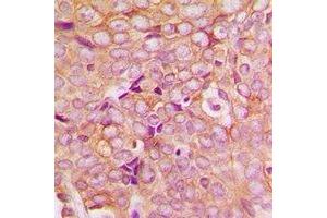 Immunohistochemistry (IHC) image for anti-PDZ and LIM Domain 5 (PDLIM5) antibody (ABIN7308152) (PDLIM5 抗体)