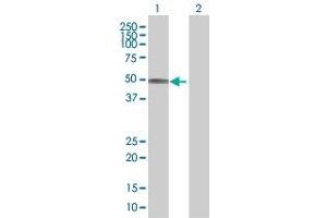 Lane 1: SLC16A1 transfected lysate ( 55. (SLC16A1 293T Cell Transient Overexpression Lysate(Denatured))