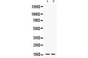 Observed bind size: 16KD (TTR 抗体  (AA 21-147))
