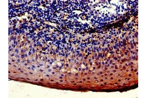 Immunohistochemistry of paraffin-embedded human tonsil tissue using ABIN7158609 at dilution of 1:100 (LYVE1 抗体  (AA 20-238))