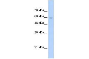 Western Blotting (WB) image for anti-Solute Carrier Family 22 (Organic Cation Transporter), Member 1 (SLC22A1) antibody (ABIN630309)