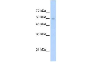 SLC22A1 antibody used at 2. (SLC22A1 抗体)