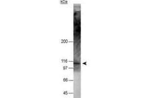 Western blot analysis of NOD2 in 50 ug of HT-29 cell lysate with NOD2 monoclonal antibody, clone 2D9 . (NOD2 抗体  (AA 28-301))