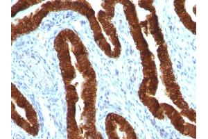 Immunohistochemistry (IHC) image for anti-Keratin 19 (KRT19) antibody (ABIN6939947)