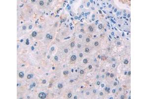 Used in DAB staining on fromalin fixed paraffin- embedded Kidney tissue (NSMAF 抗体  (AA 176-575))