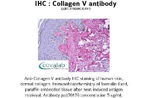 Image no. 1 for anti-Collagen, Type V (COL5) antibody (ABIN1733224) (Collagen Type V 抗体)