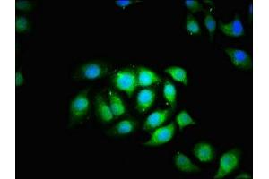 Immunofluorescence staining of A549 cells with ABIN7171419 at 1:166, counter-stained with DAPI. (CCT5 抗体  (AA 1-270))