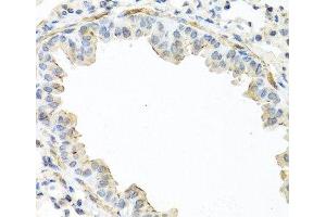 Immunohistochemistry of paraffin-embedded Mouse lung using IL22 Polyclonal Antibody at dilution of 1:100 (40x lens). (IL-22 抗体)
