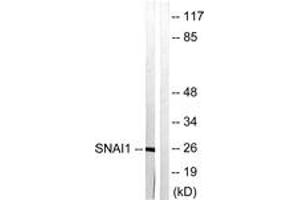 Western blot analysis of extracts from HT29 cells, using SNAI1 (Ab-246) Antibody. (SNAIL 抗体  (AA 215-264))