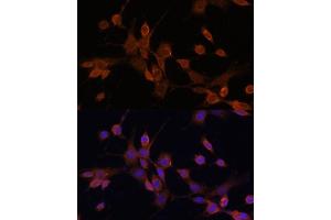 Immunofluorescence (IF) image for anti-Mitogen-Activated Protein Kinase Kinase 3 (MAP2K3) (AA 1-170) antibody (ABIN6143484)