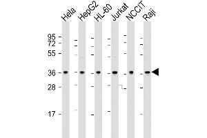 Western Blot at 1:2000 dilution Lane 1: Hela whole cell lysate Lane 2: HepG2 whole cell lysate Lane 3: HL-60 whole cell lysate Lane 4: Jurkat whole cell lysate Lane 5: NCCIT whole cell lysate Lane 6: Raji whole cell lysate Lysates/proteins at 20 ug per lane. (OGG1 抗体  (C-Term))