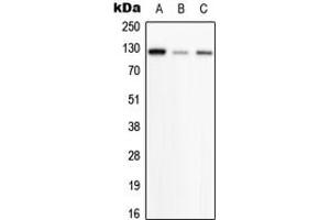 Western blot analysis of PHKB expression in HeLa (A), SP2/0 (B), H9C2 (C) whole cell lysates. (PHKB 抗体  (Center))