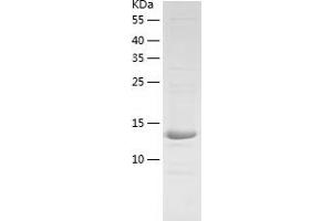 Western Blotting (WB) image for Chemokine (C-C Motif) Ligand 2 (CCL2) (AA 24-148) protein (His-IF2DI Tag) (ABIN7122279)