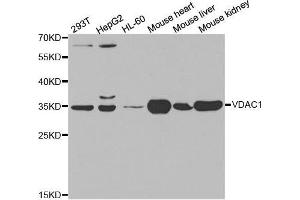 Western blot analysis of extracts of various cell lines, using VDAC1 antibody. (VDAC1 抗体  (AA 1-283))