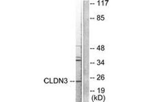 Western blot analysis of extracts from HuvEc cells, using Claudin 3 Antibody. (Claudin 3 抗体  (AA 171-220))