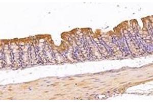 Immunohistochemistry analysis of paraffin-embedded mouse colon using,KIF5B (ABIN7074440) at dilution of 1: 1000 (KIF5B 抗体)