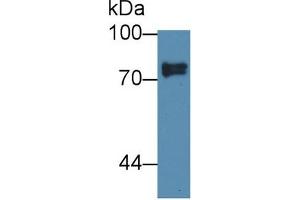 Western Blot; Sample: Human Lung lysate; Primary Ab: 1µg/ml Rabbit Anti-Human SCEL Antibody Second Ab: 0. (SCEL 抗体  (AA 519-685))