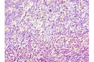Immunohistochemistry of paraffin-embedded human tonsil tissue using ABIN7143696 at dilution of 1:100 (AKR1C4 抗体  (AA 1-323))