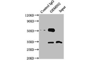 Immunoprecipitating GEMIN2 in 293T whole cell lysate Lane 1: Rabbit control IgG instead of ABIN7153753 in 293T whole cell lysate. (SIP1 抗体  (AA 1-280))