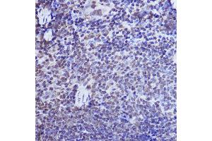 Immunohistochemistry of paraffin-embedded mouse spleen using POLR2A Rabbit pAb (ABIN6130298, ABIN6145914, ABIN6145915 and ABIN6215095) at dilution of 1:50 (40x lens). (POLR2A/RPB1 抗体  (AA 1-260))