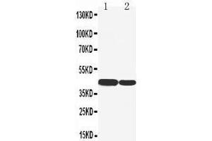 Anti-Cytokeratin 19 antibody, Western blotting Lane 1:  Cell Lysate Lane 2: COLO320 Cell Lysate (Cytokeratin 19 抗体  (C-Term))