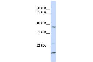 WB Suggested Anti-ZDHHC19 Antibody Titration:  0. (ZDHHC19 抗体  (N-Term))