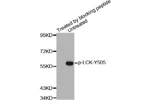 Western blot analysis of extracts from JK cells using Phospho-LCK-Y505 antibody and the same antibody preincubated with blocking peptide. (LCK 抗体  (pTyr505))