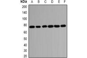 Western blot analysis of HSPA2 expression in SKOV3 (A), Hela (B), A431 (C), mouse brain (D), mouse testis (E), rat kidney (F) whole cell lysates. (HSPA2 抗体)