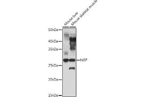 Western blot analysis of extracts of various cell lines, using NGF antibody (ABIN3020811, ABIN3020812, ABIN3020813 and ABIN6213735) at 1:1000 dilution. (Nerve Growth Factor 抗体  (AA 19-241))