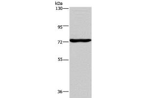 Western Blot analysis of Mouse brain tissue using KCND1 Polyclonal Antibody at dilution of 1:400 (KCND1 抗体)