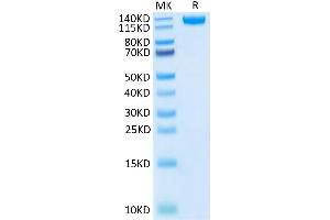 SDS-PAGE (SDS) image for SARS-CoV-2 Spike S1 (AA 14-683) protein (Fc-Avi Tag,Biotin) (ABIN7274410)