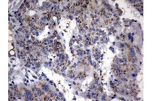 Immunohistochemistry (IHC) image for anti-ATP-Binding Cassette, Sub-Family D (Ald), Member 1 (ABCD1) (AA 508-745) antibody (ABIN2715622) (ABCD1 抗体  (AA 508-745))