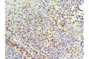 Immunohistochemistry of paraffin-embedded human tonsil tissue using ABIN7156854 at dilution of 1:100 (IL22 Receptor alpha 1 抗体  (AA 16-230))