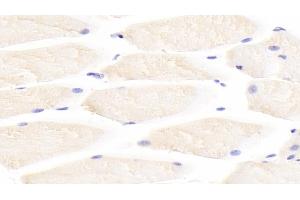 Detection of IL31 in Mouse Skeletal muscle Tissue using Polyclonal Antibody to Interleukin 31 (IL31) (IL-31 抗体  (AA 28-154))